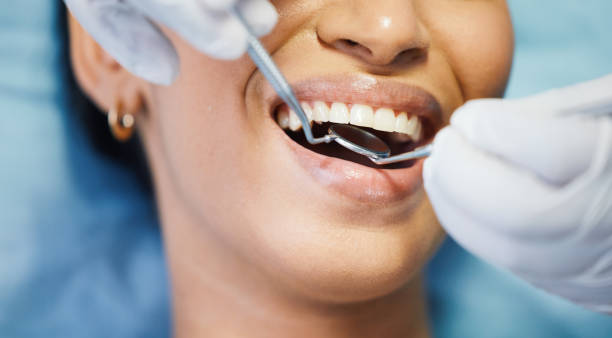 Best Emergency Dental Care for Abscessed Tooth in Honokaa, HI