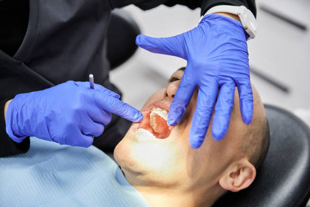 Best Emergency Dentist for Knocked-Out Tooth in Honokaa, HI